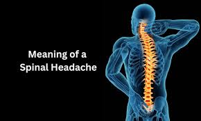 Image result for Spinal Headache