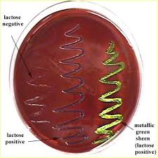 Emb Remember The Green Sheen Microbiology Study Microbiology Microbiology Lab