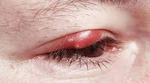 Open the eyes of my heart is a song written by paul baloche and this is based on ephesians 1:18. What Your Eye Symptoms May Mean Visionplus Magazine
