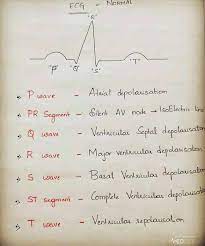 Ecg Facts This Should Help Out A Lot In Med School Cardioligy Medical Mcat Medicald Medical School Studying Medical Student Study Medical School Quotes