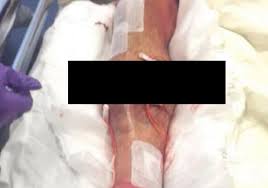 There was a long break in play as medics gathered around to provide. Luke Shaw Broken Leg Picture Reported Snap Of Defender S Leg Surfaces