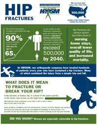 Hip Fractures Infographic Hip Fracture Infographic Serious Injury