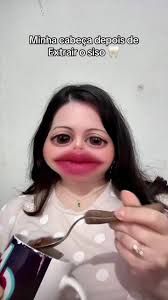 Vontade de mastigar comida de verdade! 🙂‍↔️ #siso #extracaosiso #dentista  #dentedojuizo #dente