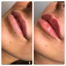 Nur wenige sekunden vom königsplatz entfernt. Julia Schmid Heilpraktikerin Posts Facebook