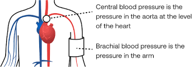Image result for Pulse Pressure