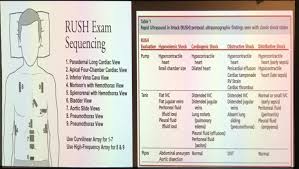 For the rush exam, we generally look to break down lv function into broad categories including hyperdynamic, normal, or diminished, with lesser focus on the exact ejection fraction. John Noel Chan On Twitter Rush Exam Sequence For Pocus Avkwong At Sganzics 2018