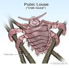 Image result for pubic lice symptoms