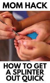Mom Hack How To Get A Splinter Out Quickly In 2020 Mom Generations Mom Hacks Parenting Hacks