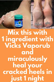 Diy foot soak foot soaks foot soak vinegar thick toenails listerine foot soak ingrown toe nail soft feet epsom salt natural cures. Pin On Beauty Hacks