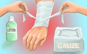 Our Whiskey Lullaby How To Treat Severe Burns Burns Treatment Severe Burns First Aid Treatment