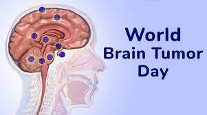 Some people with several risk factors never develop a brain tumor, while others with no known risk. World Brain Tumor Day 2021 History And Significance Know More About The Day Observed To Raise Public Awareness About Brain Tumour