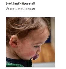 Intense Outbreak Continues To Circulate In Bermuda Says Health Minister Kim  Wilson This Just In The Ministry of Health received 578 test results since  the last update, and 12 were positive for