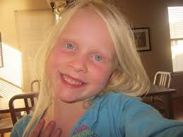  i know for a fact when an albino dyes their hair because of their genetics it turns blue. Albinism New By Isaiah East Infographic