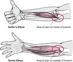 If your symptoms are better in the morning, this could mean you have a mild nerve compression. Elbow Pain