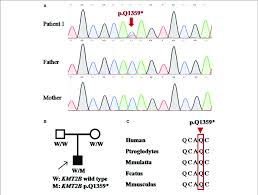 Detection Of Kmt2b Nonsense Mutation P Q1359 In Patient 1