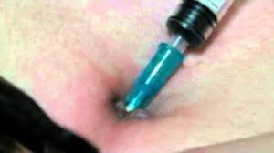 A 14 gauge sterile piercing needle, a 14 gauge belly button ring made from stainless steel, titanium or bioplast, some rubbing alcohol or alcohol wipes, a body ink marker, a piercing clamp and some cotton balls. Navel Torture Youtube