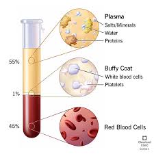 Image result for Plasma Transfusion