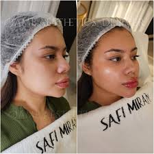 Reviews of Safi Miran Rejuvenation Center Denver