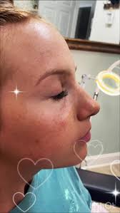 Vera Bush (@verabushnurseinjector)