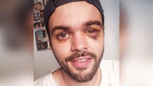 Detuvieron a cuatro jóvenes por la brutal golpiza al rugbier gay