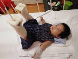 Jika anda laki laki download our app. Sedih Tengok Bayi 3 Bulan Patah Tulang Paha Ayah Mangsa Mohon Keadilan Untuk Anaknya Pa Ma