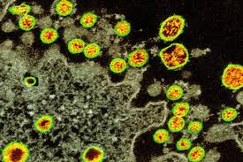 Maybe you would like to learn more about one of these? Can You Catch The Coronavirus Twice We Don T Know Yet New Scientist