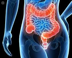 Up to 40% of nodes under 5. The Different Stages Of Colorectal Cancer
