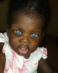 Il Cerchio Si Apre Volontari nel Mondo: BIMBA DEL GHANA NATA CON GLI OCCHI  AZZURRI DIVENTA VITTIMA DELL'IGNORANZA