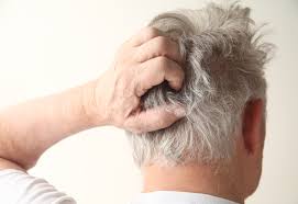 Most of the time, these d. How To Get Rid Of Hair Mites