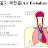암이나 특정 유전성 혈전 장애 같은 일부 장애는 혈액이 응고되지 말아야 할 때 원인이 일시적이지 않은 경우(예: Https Encrypted Tbn0 Gstatic Com Images Q Tbn And9gcrkb9ke4vvrnb3nsqknh3lpasorhe24bhcl7sarehkyjiexiy16 Usqp Cau