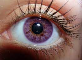 We did not find results for: 7 Rarest And Unusual Eye Colors That Looks Unreal Pouted Com In 2021 Violet Eyes Rare Eyes Purple Eyes