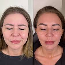 Okay let's talk about the top lip