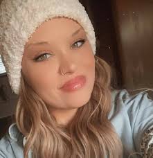 Is low potassium a common lupus side effect?