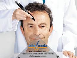 Sac Ekimi 2 Yil Sonra