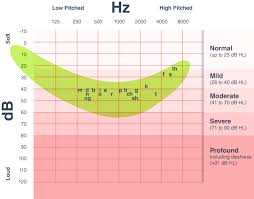 What An Audiogram Says About Your Hearing Loss The Hearing