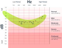 what an audiogram says about your hearing loss the hearing