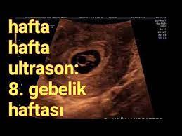 8 gebelik haftasinda anne karnindaki bebek kalp atis sayisi yolk kesesi crl olcumu youtube