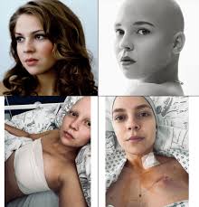 Breast Cancer Stage 4: Very Young Age, Triple Negative, New Mothers:  Features of COVID-19 mRNA Vaccine Turbo Cancer; 30 Cases