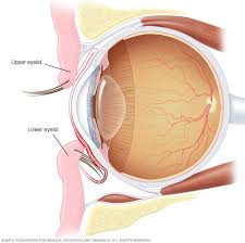 Image result for Entropion