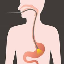 Endoscopy describes many procedures that look inside the body using some type of endoscope, a flexible tube with a small tv camera and a. Endoscopy Colonoscopy Procedure Preparation Eviva Seattle Wa