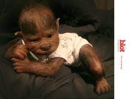 Hypertrichosis or human werewolf syndrome is growth of excessive hair, either all over the body or in specific areas of the body. 17 Babies In Spain Get Werewolf Syndrome After Drug Error Scary Baby Dolls Baby Dolls Scary Dolls