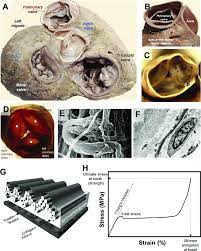 Anatomy Of Human Heart Valves A The Pulmonary Valve In Opened B Download Scientific Diagram