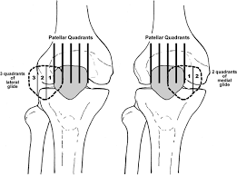 Image result for Patella Mobility Test