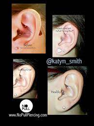 Look At This Daith With The Dreaded Bump See How As Each Week Goes By The Bump Subsides And There Is More Space On The Barbell Add Piercing Daith O Ring