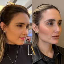 Esse antes e depois carrega técnica, maturidade e escolhas conscientes...