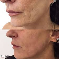 Clinic Medical Beauty