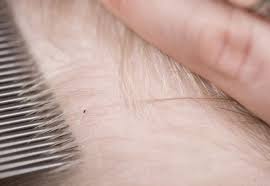 Kopflause Richtig Behandeln Friseur Com