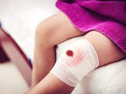 If you are experiencing lack of circulation, pain, or heaviness in certain areas, you might be having vascular pain. Symptoms And Complications Of Blood Clots