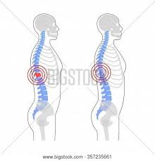 We did not find results for: Human Spine Pain Vector Photo Free Trial Bigstock