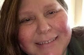 Fundraiser for Donna Graves Richburg by Ginger Graves : Mobility Scooter &  Medical Bills